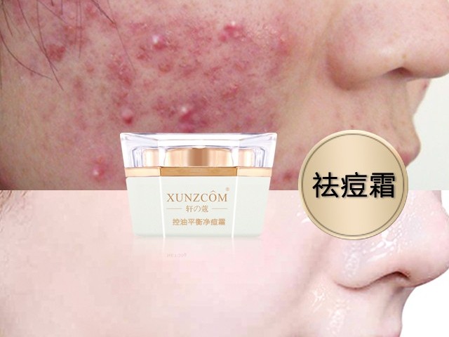 控油平衡凈痘霜-歐泉生化 控油平衡凈痘霜-歐泉生化